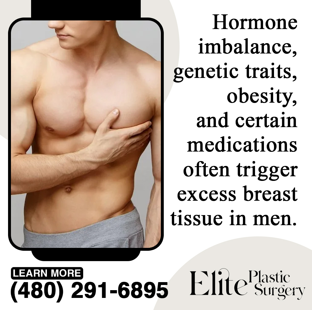 Causes of Gynecomastia